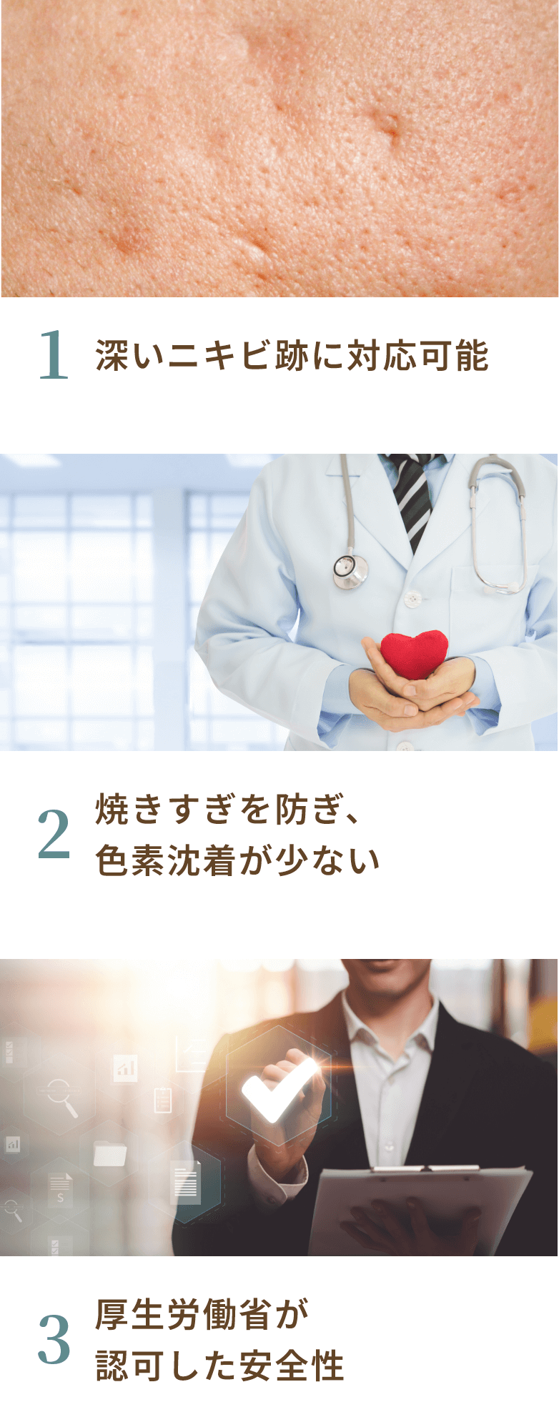 アキュパルスの特徴