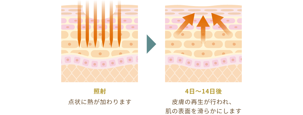 治療のメカニズム