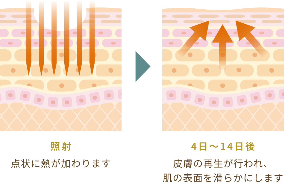 治療のメカニズム