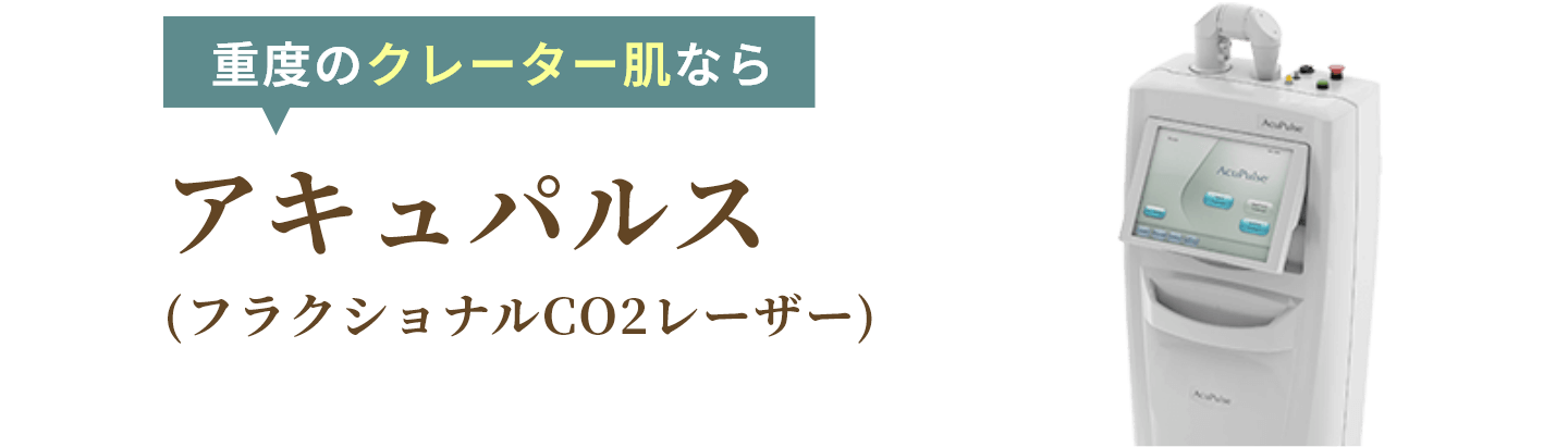 アキュパルス