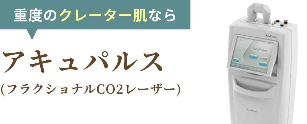 アキュパルス