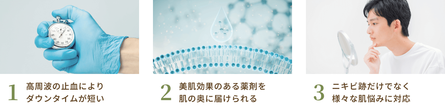 ポテンツァの特徴