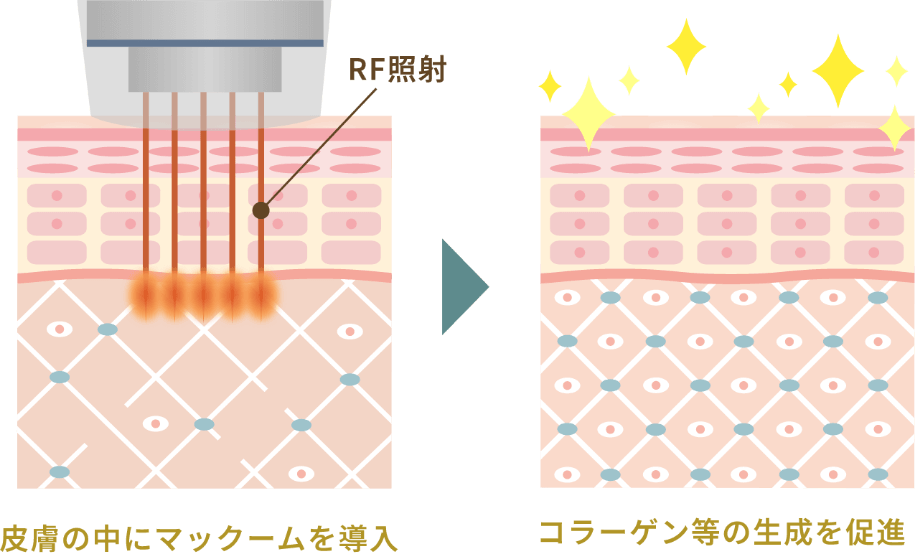 トライアル価格