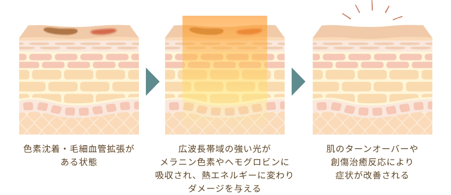 治療のメカニズム