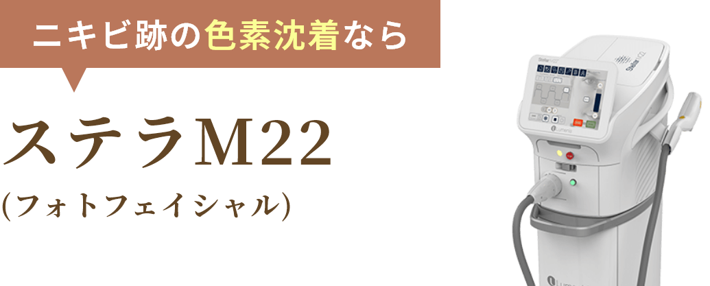 ステラM22